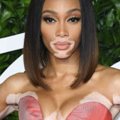 Winnie Harlow 