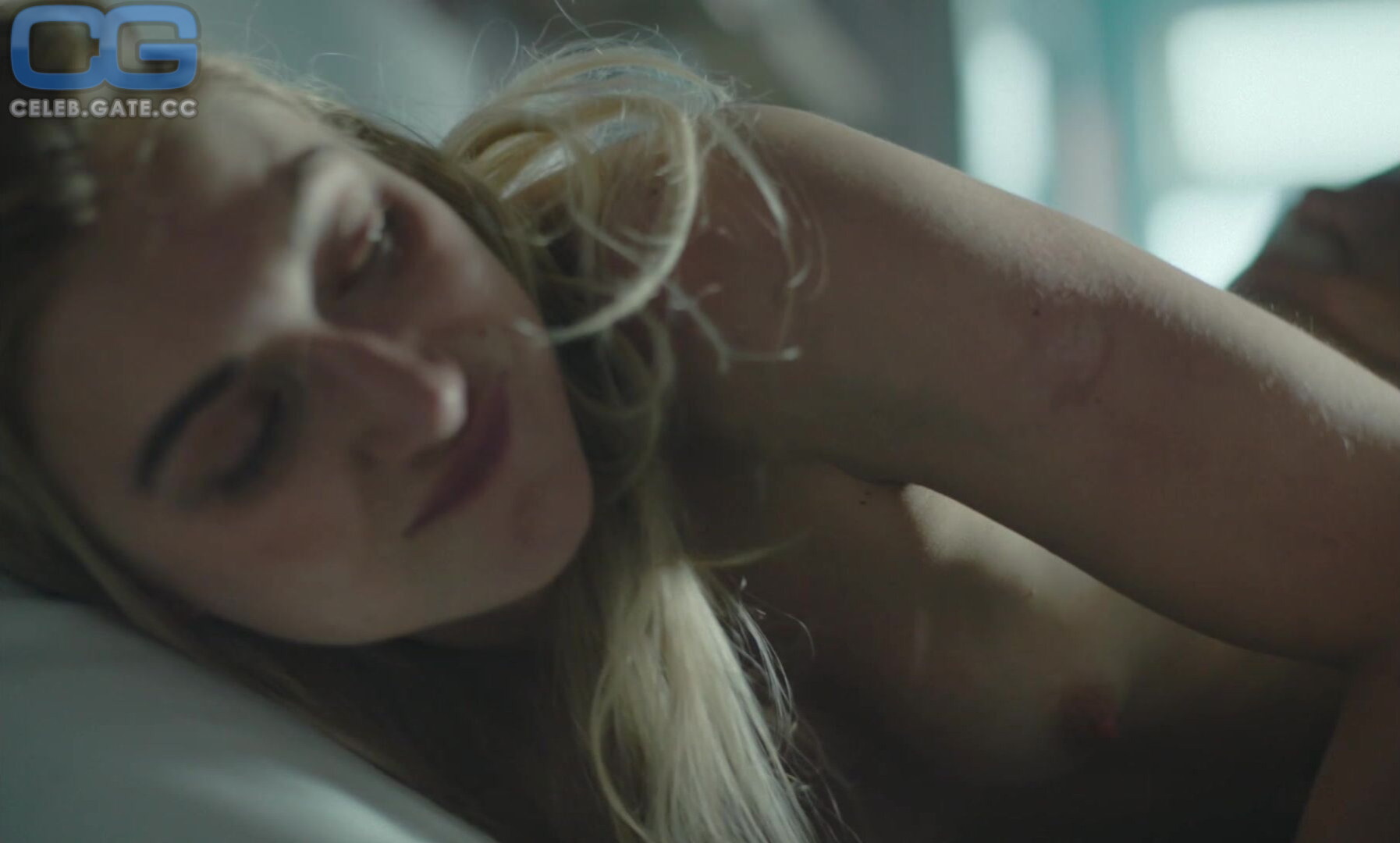 Imogen Poots 